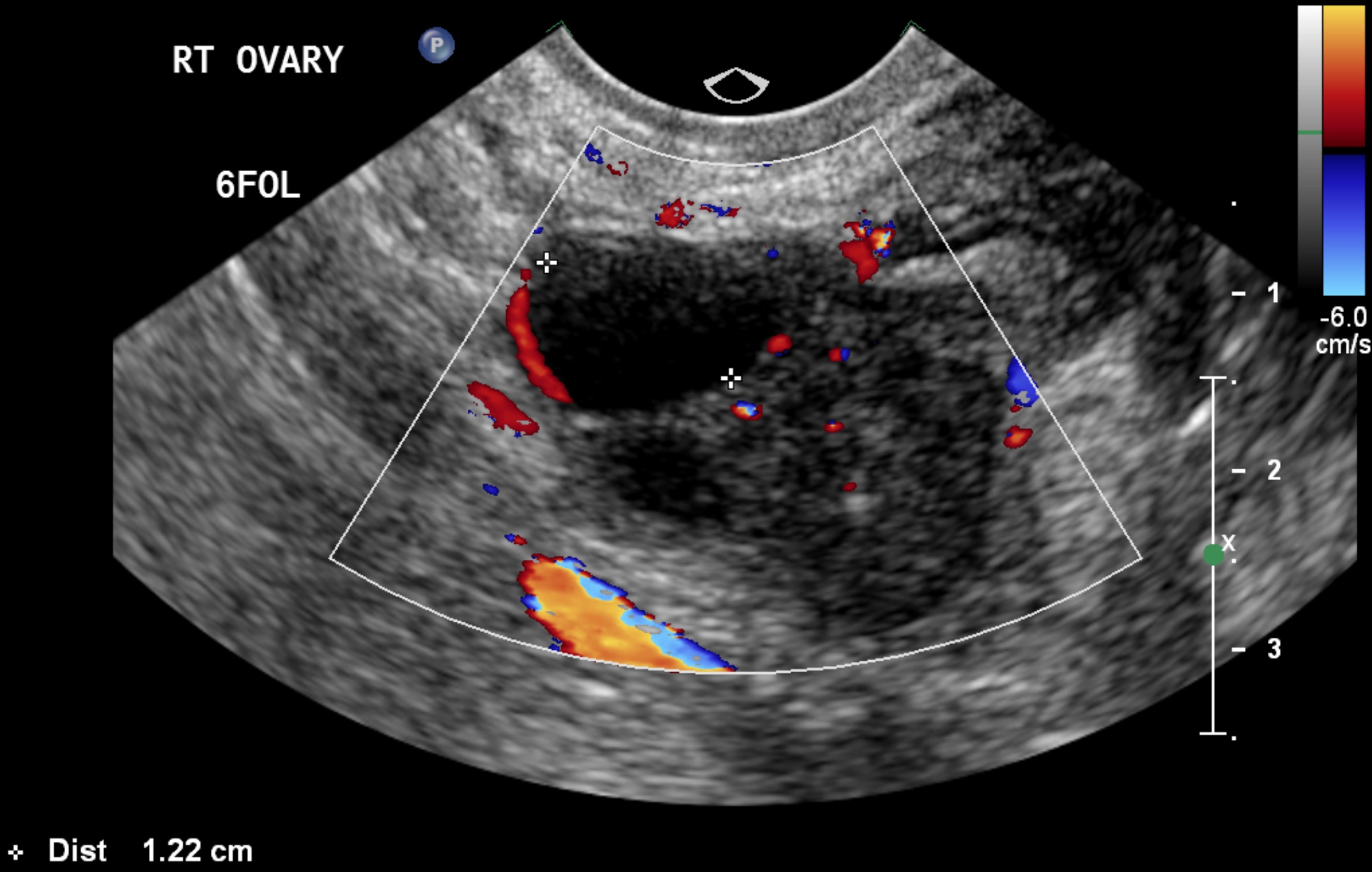 Image | Radiopaedia.org