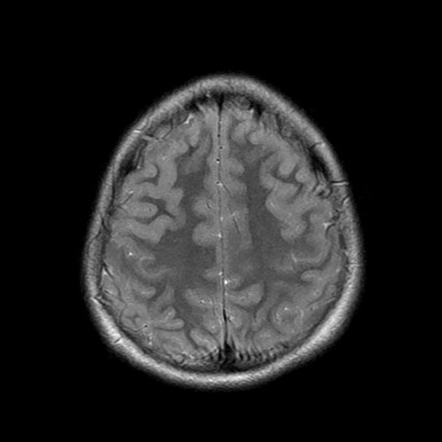 mz 19001, COCCINELLA, mz 19002, GLOBO,mz 19003, UOMO VITRUVIANO,mz 19004,  RADIOLOGIA, mz 19005, GONIOMETRO, mz 19006, FILOSOFIA, mz 19007, DENTE, mz  19008, TOCCO, mz 19009,PSICOLOGIA, mz 19010 CADUCEO, CERVELLO,mz18059, PI  GRECO,mz18060, RELATIVITA',mz180