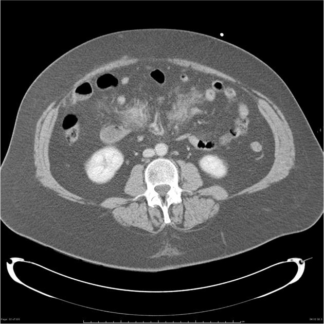 Radiology Quiz 26303 | Radiopaedia.org