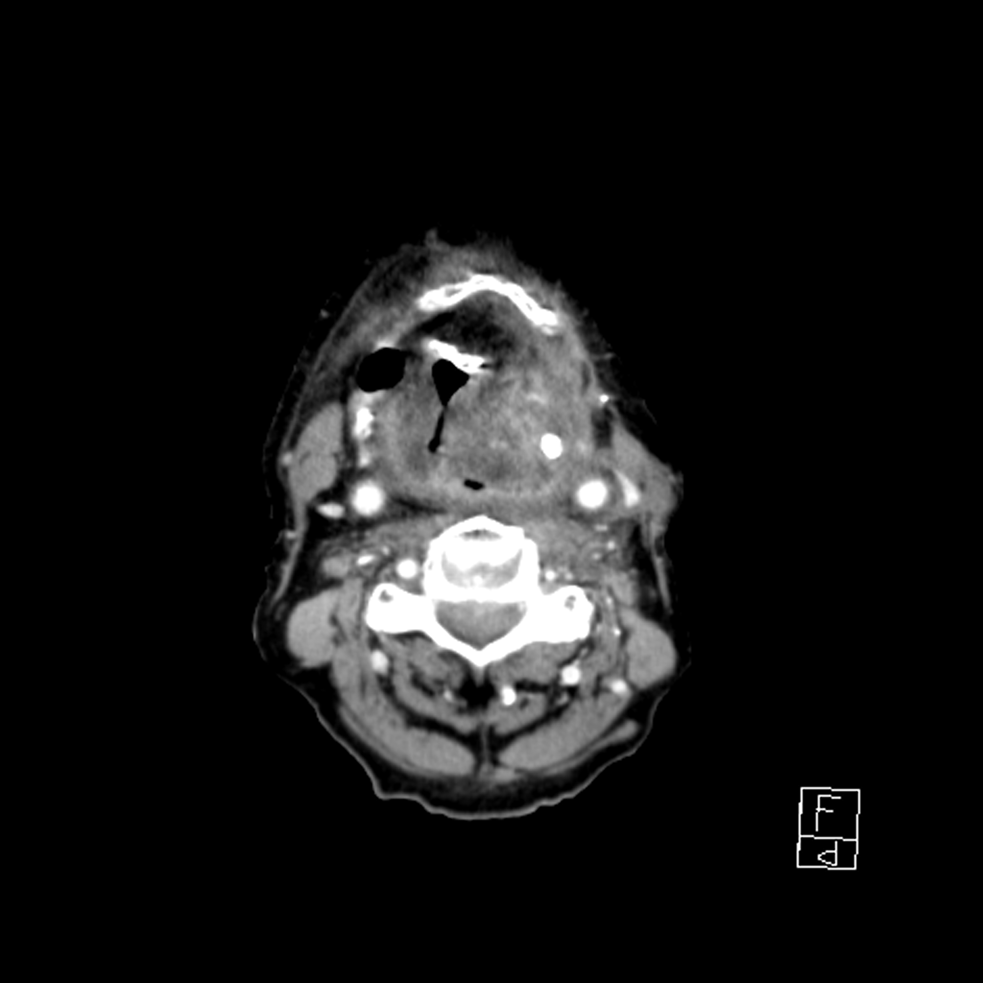 Radiology Quiz 79088 | Radiopaedia.org