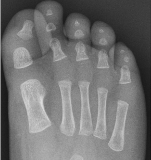 Male Foot  Radiology Key