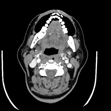 Radiology Quiz 79319 | Radiopaedia.org