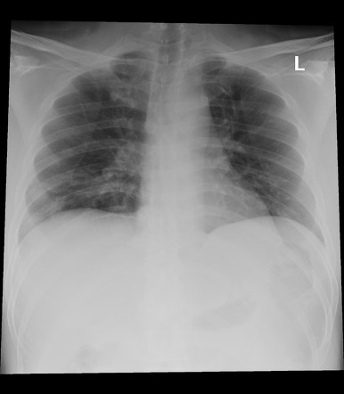 Radiology Quiz 79551 | Radiopaedia.org