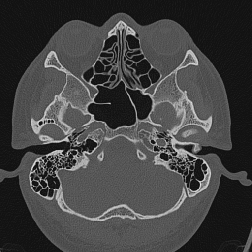 Image | Radiopaedia.org