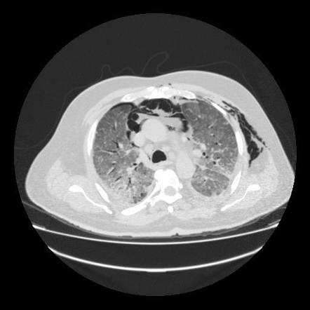 Radiology Quiz 79837 | Radiopaedia.org