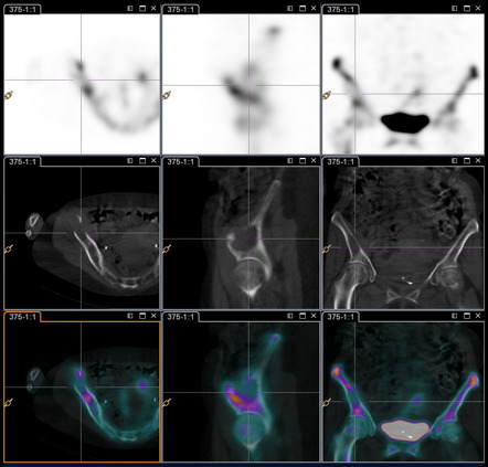 fMRI vs. SPECT Scan for the Brain