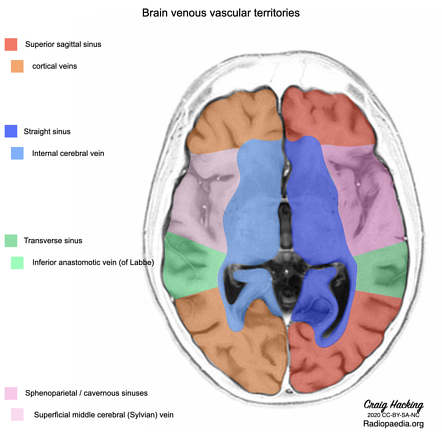 Superior cerebral veins - Wikipedia