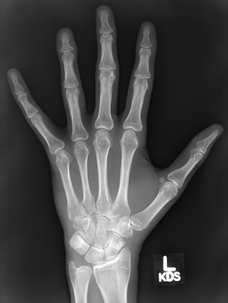 Radiology Quiz 80423 | Radiopaedia.org