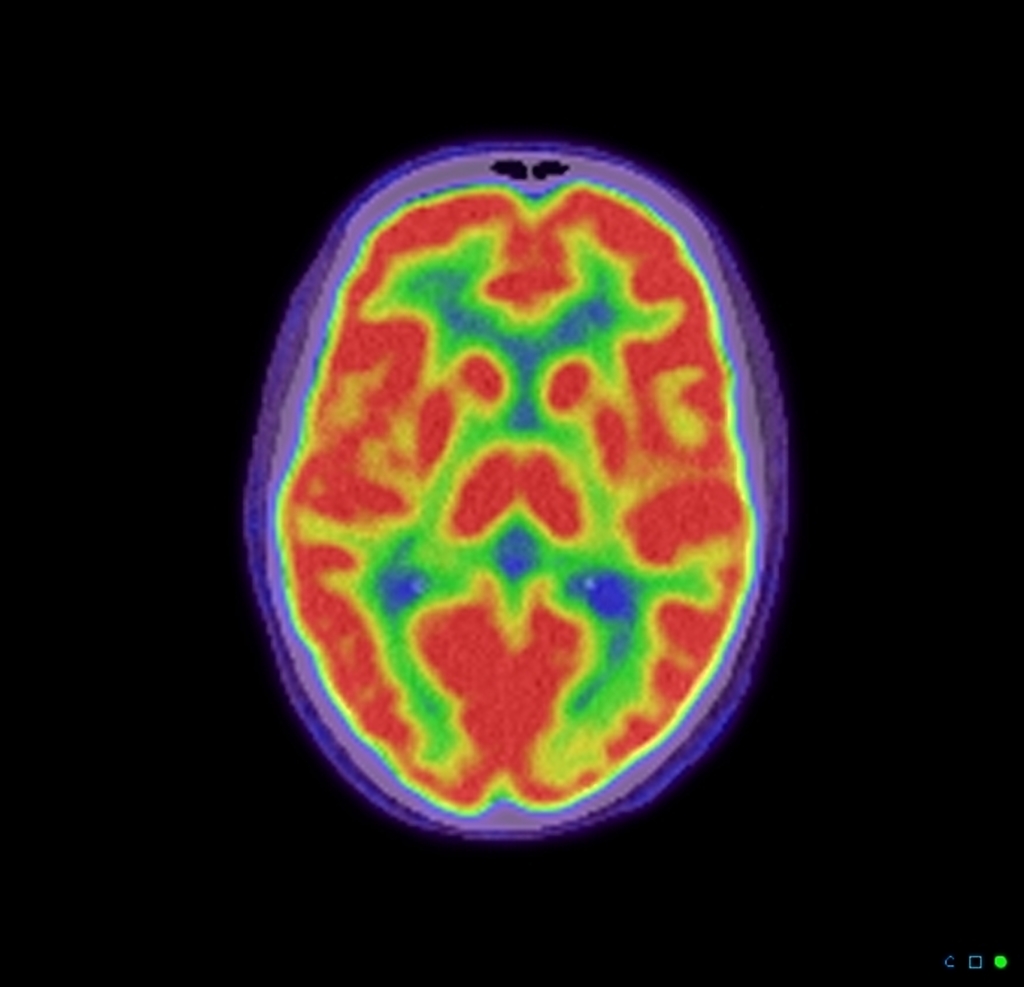 pet brain scan