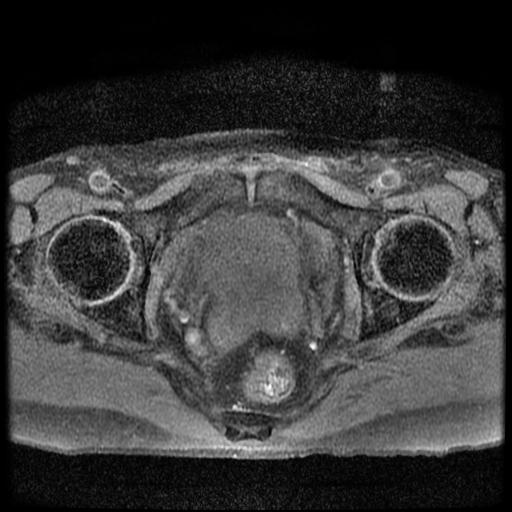 image-radiopaedia