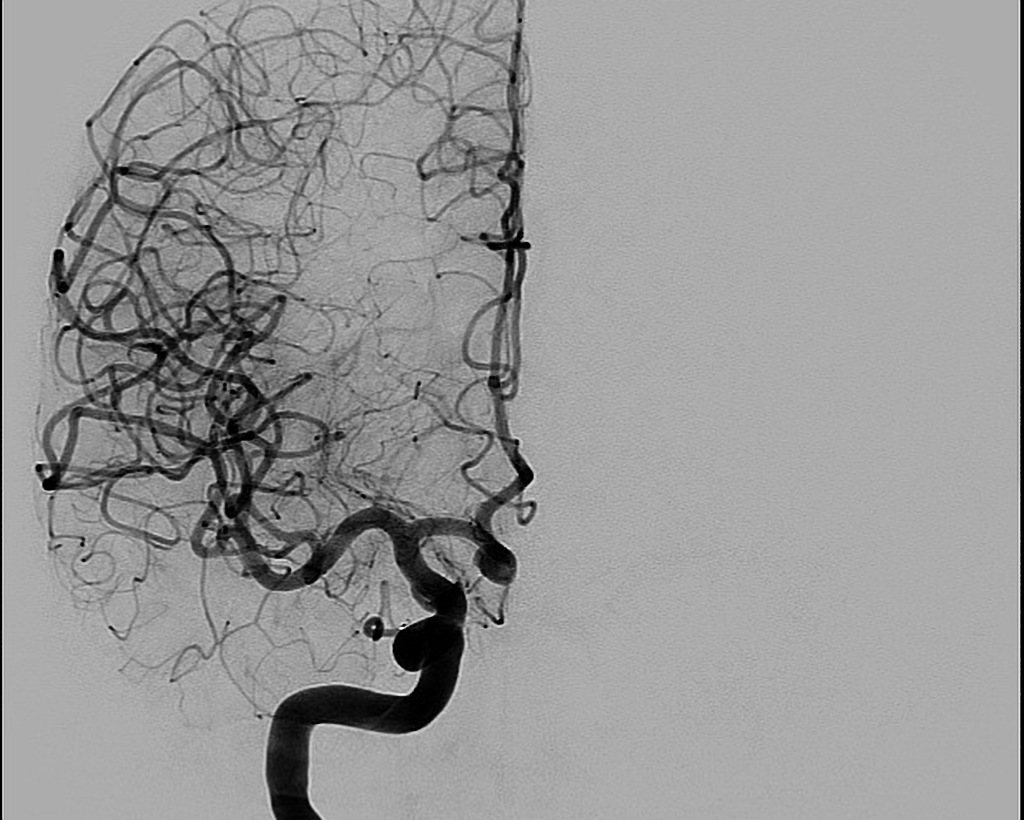 Radiology Quiz 80683 | Radiopaedia.org