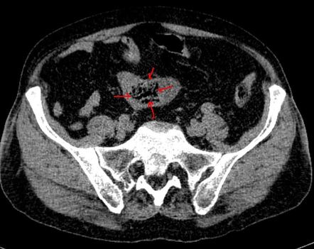 Images | Radiopaedia.org