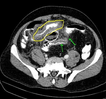 Images | Radiopaedia.org