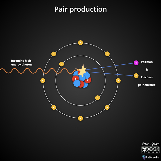 Pair Production | Radiology Reference Article | Radiopaedia.org