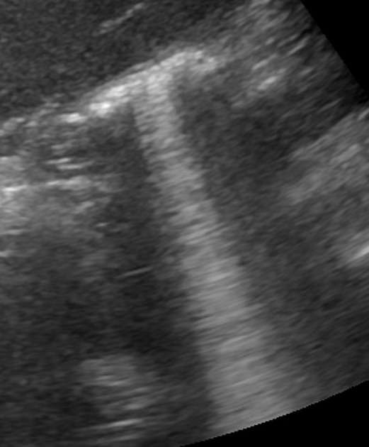  Ultrasound Physics Scanning AND Modes M Mode  0de40fe35c92016c69453bc015ae8f_big_gallery