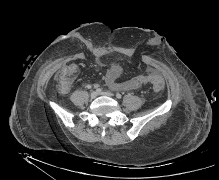 Image Radiopaedia Org