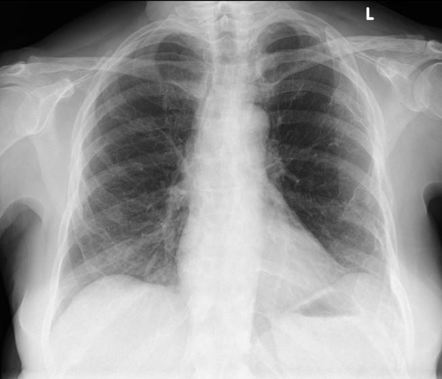 Radiology Quiz 81192 | Radiopaedia.org