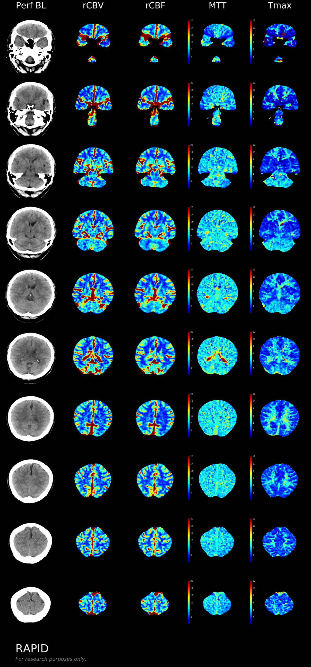 Image Radiopaedia Org