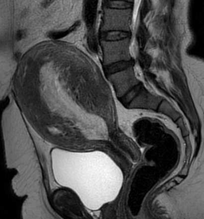 Radiology Quiz 81919 | Radiopaedia.org