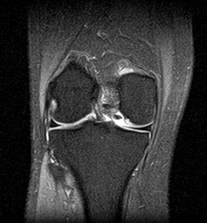 Radiology Quiz 82141 | Radiopaedia.org