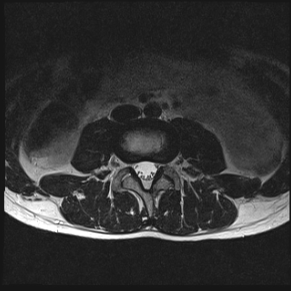 Images | Radiopaedia.org