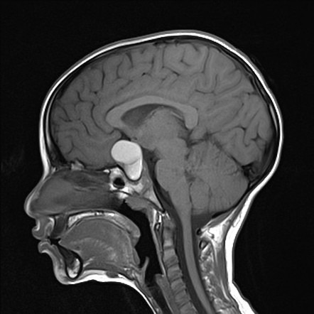 Radiology Quiz 82344 | Radiopaedia.org