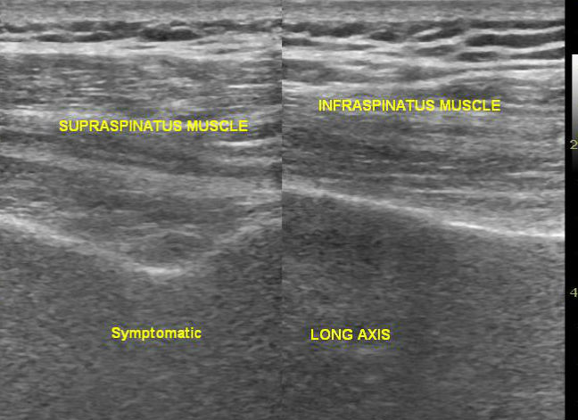 Image | Radiopaedia.org