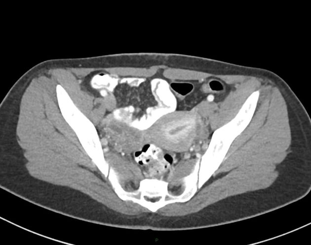 Radiology Quiz 82925 | Radiopaedia.org