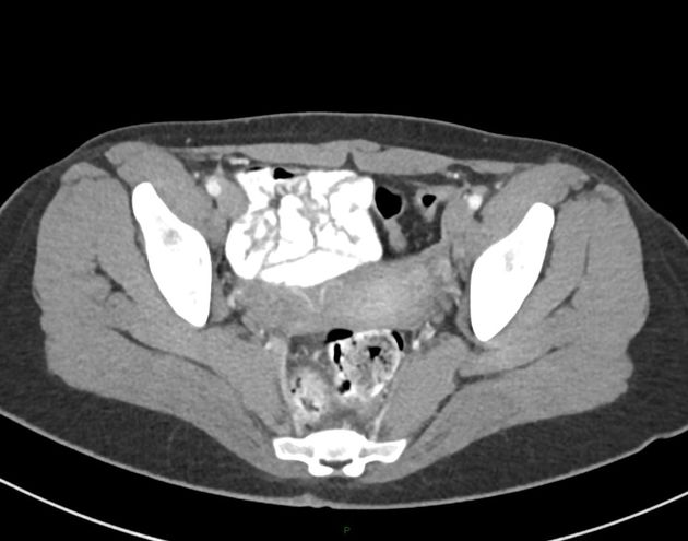 Radiology Quiz 82925 | Radiopaedia.org