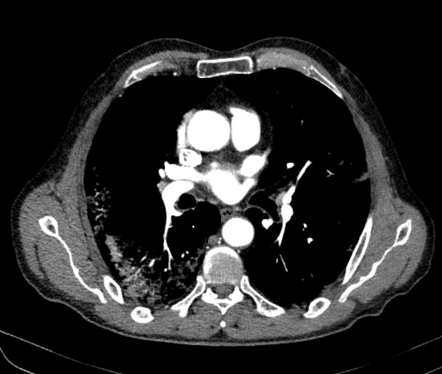 Image | Radiopaedia.org