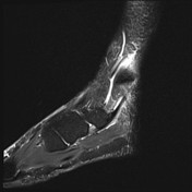 Viewing playlist: #07 Trauma of the musculoskeletal system ...