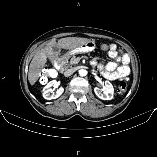 Image | Radiopaedia.org