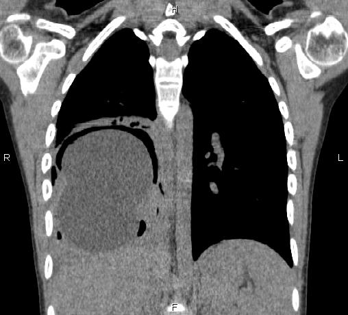 Image | Radiopaedia.org