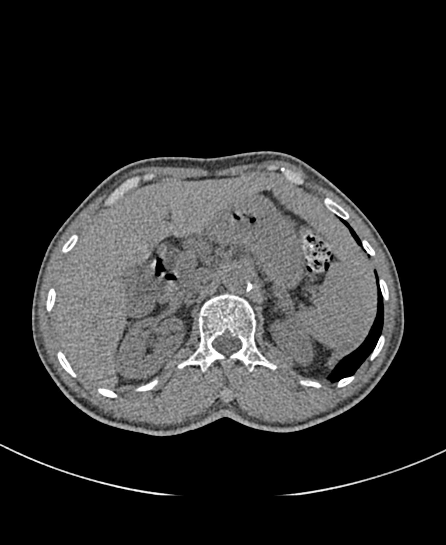 Radiology Quiz 84947 | Radiopaedia.org