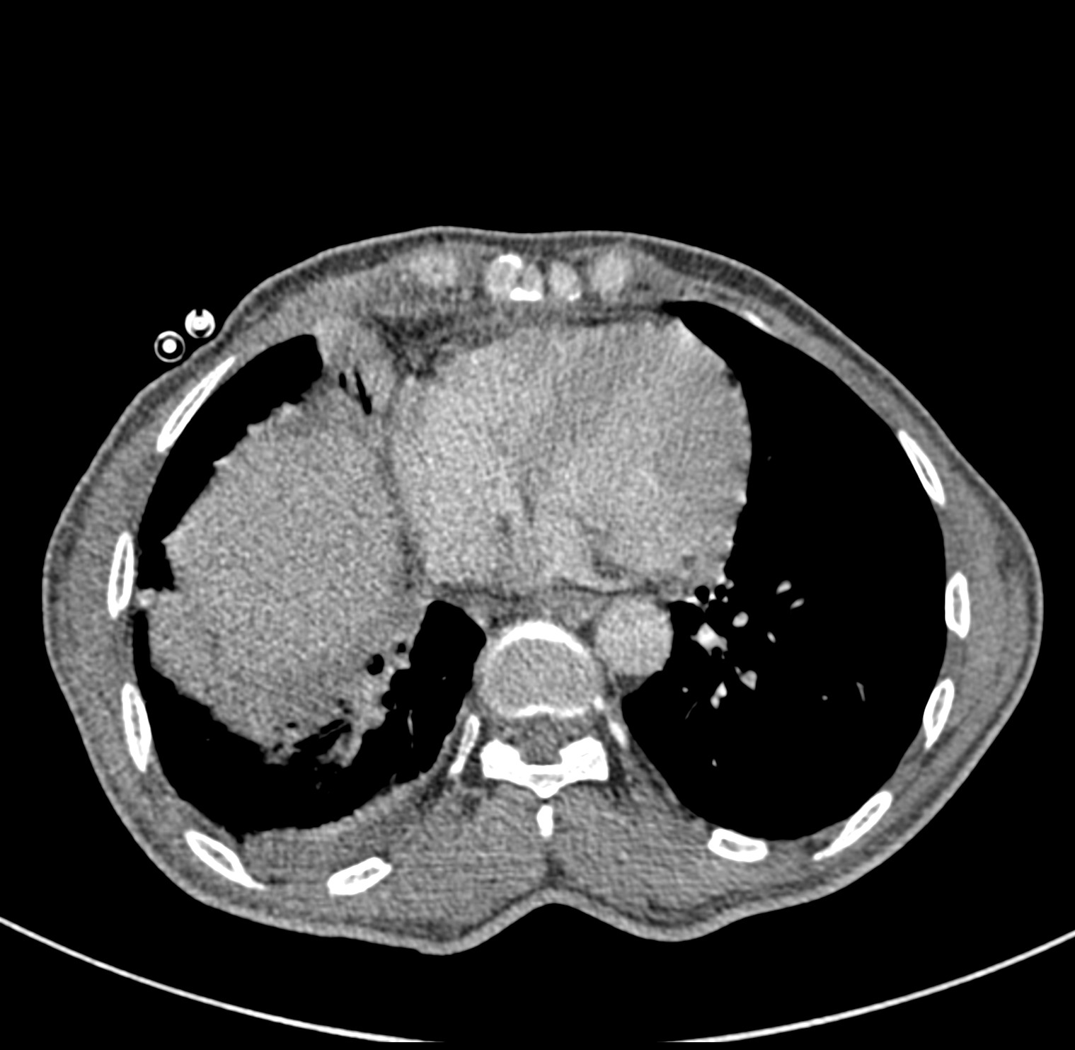 Radiology Quiz 84947 | Radiopaedia.org