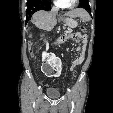 Radiology Quiz 85048 | Radiopaedia.org