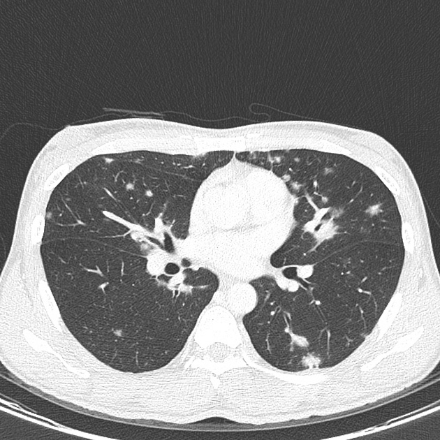 Radiology Quiz 85247 | Radiopaedia.org