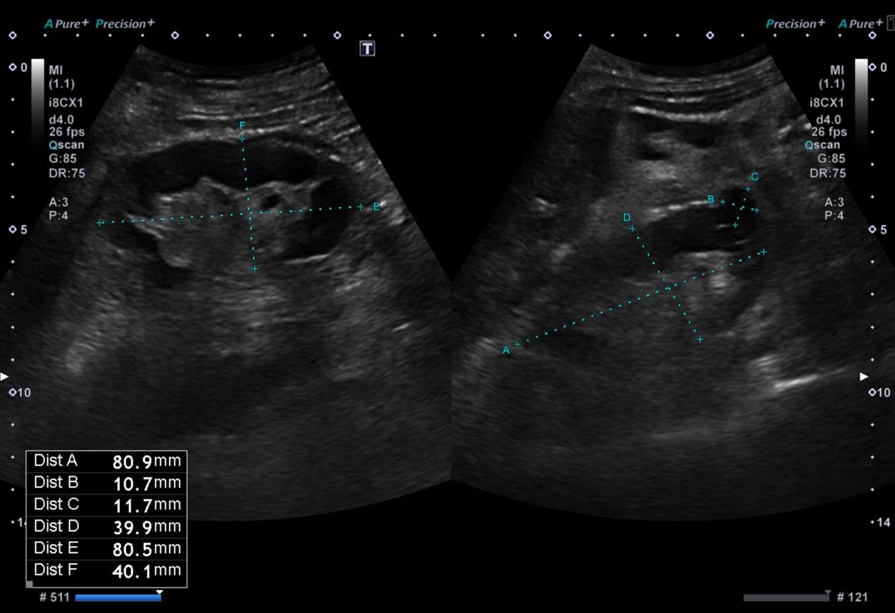 Image | Radiopaedia.org