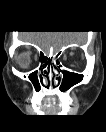 Images | Radiopaedia.org