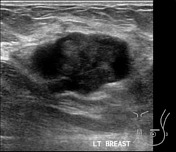 Cases | System: Breast | Radiopaedia.org