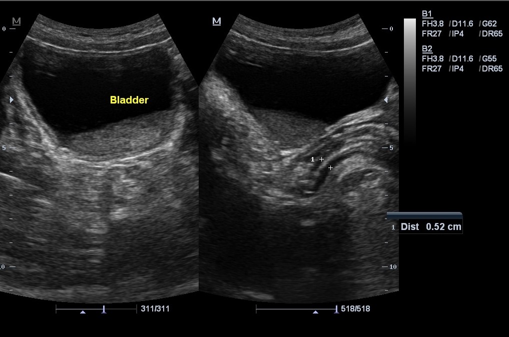 images-radiopaedia