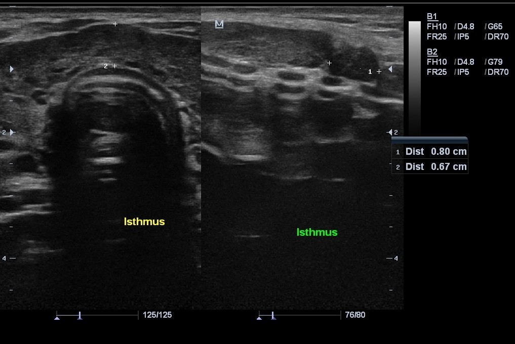 Images | Radiopaedia.org