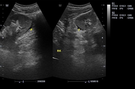 Images | Radiopaedia.org