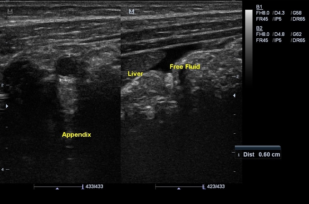 image-radiopaedia