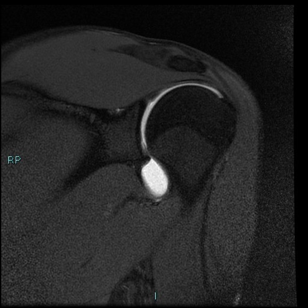 Radiology Quiz 85768 | Radiopaedia.org