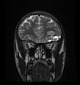 Radiology Quiz 85769 | Radiopaedia.org