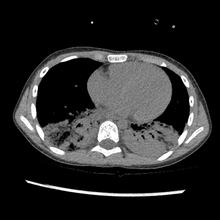 Radiology Quiz Radiopaedia Org