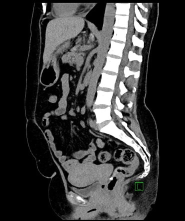 Image | Radiopaedia.org