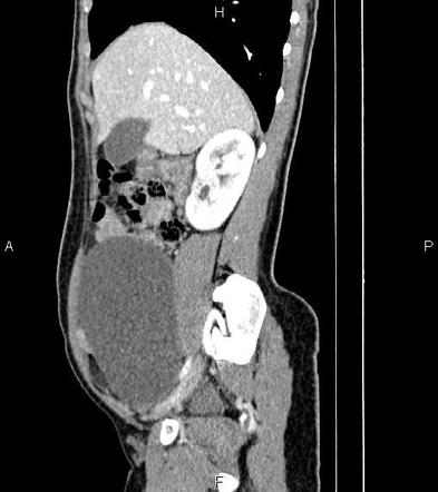 Image | Radiopaedia.org