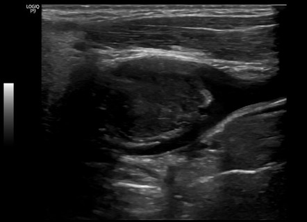 Radiology Quiz Radiopaedia Org